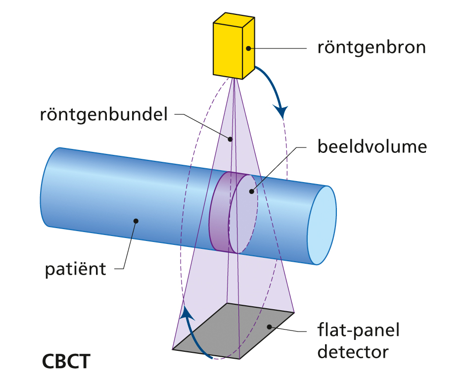 Principe van beeldvorming voor CBCT