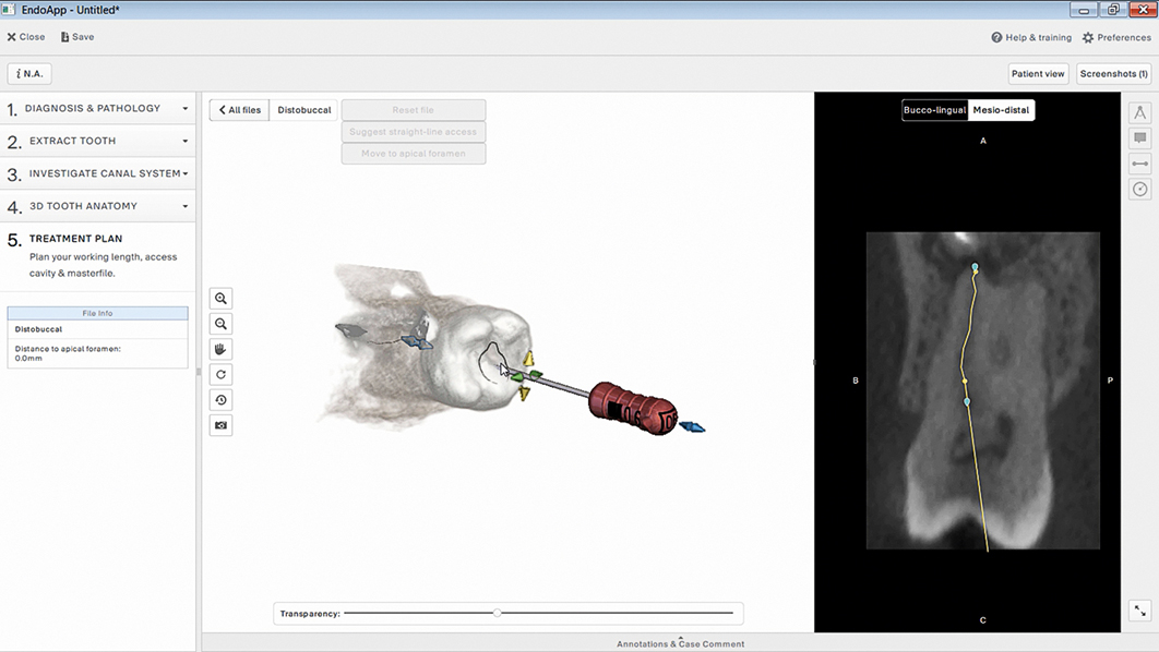 3D-endo sotware