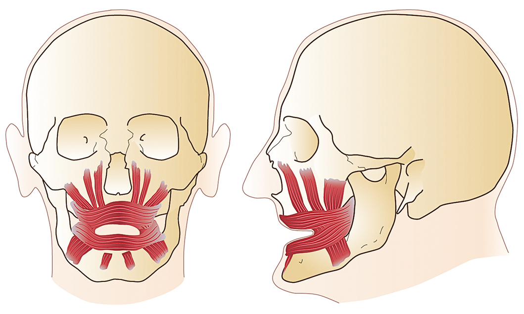 hypotonie van mimische periorale musculatuur