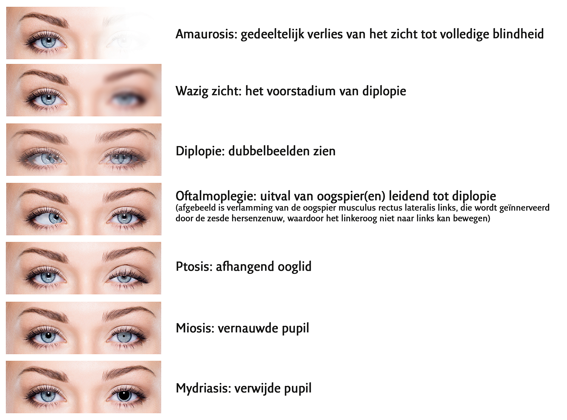 Oculaire bijwerkingen, symptomen