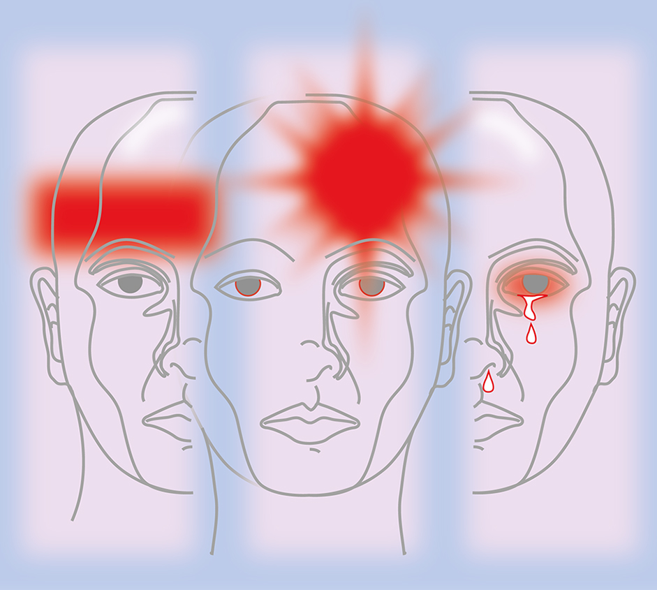 symptomen van 3 primaire hoofdpijnen