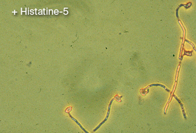 Experiment schimmeldodende eigenschap histatine-5, met histatine-5